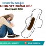 Nguyên nhân kinh nguyệt không đều màu nâu đen